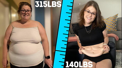 I've Been Left With 10lbs Of Excess Skin | BRAND NEW ME