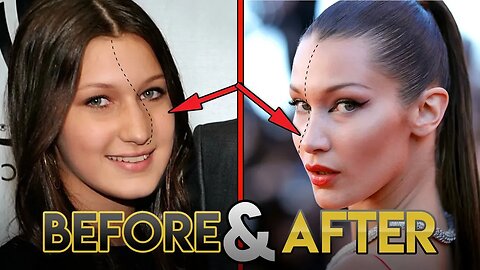 Bella Hadid | Before and After Transformations ( Plastic Surgery Rumors, Make Up, Fitness & More )