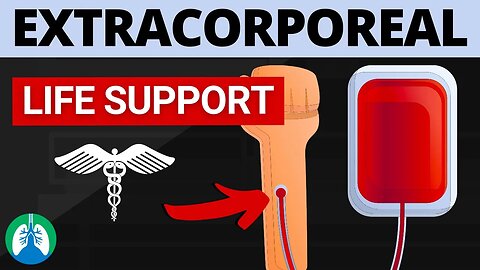 Extracorporeal Life Support (Medical Definition)