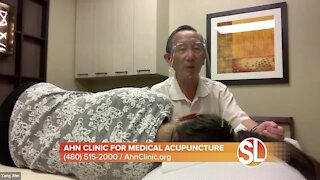 Sick of migraines? Dr. Yang Ahn uses medical acupuncture to ease the pain