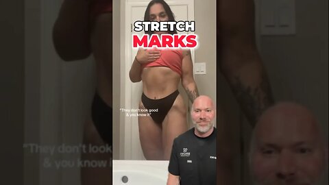 Stretch Marks Aren’t a Bad Thing ❌ #shorts