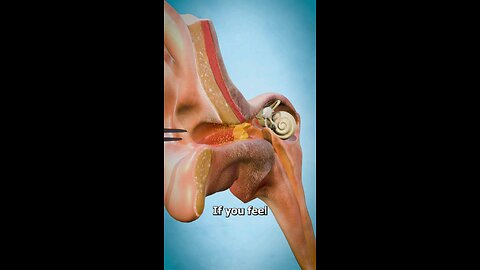 How to Properly Remove Ear Wax