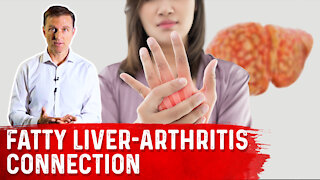 Why Does a Fatty Liver Triggers Arthritis?