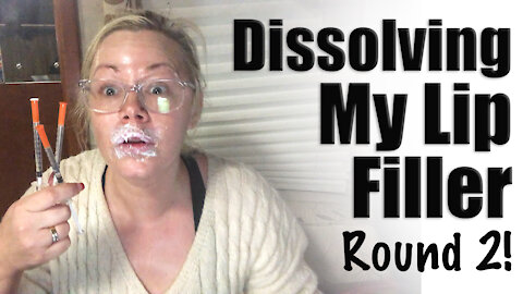 Dissolving my Lip Filler : Round 2 | Code Jessica10 saves you Money