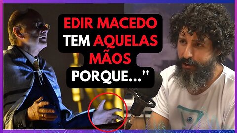 EDUARDO TEODORO FALA SOBRE AS MÃOS DE EDIR MACEDO..