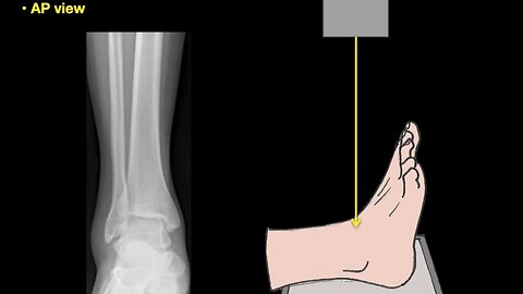 Anatomy of Ankle X-rays