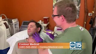Contour Medical has new treatment to reduce scars, fine lines, acne & pores