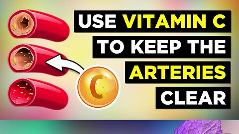 Vitamin C For Preventing Clogged Arteries