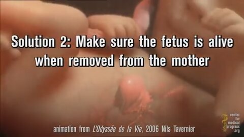 Aborted Fetal Trafficking Under Oath Planned Parenthoods Admissions! [01.05.2022]