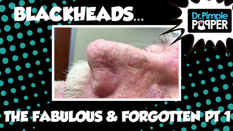 Blackheads : The Fabulous & Forgotten Files, Part One