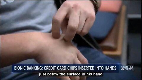 CHD 13-16 Hand Implant Microchips