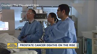 Prostate Cancer deaths on the rise but doctors still remain hopeful