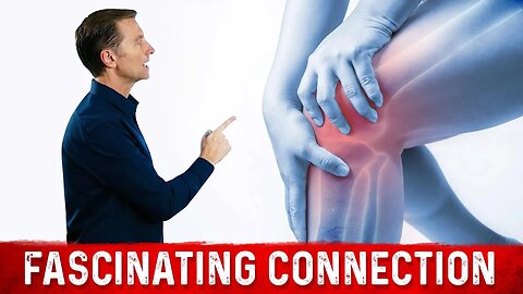 Knee Pain, Pseudogout, and Vitamin K2 Benefits – Prevent Gout with Vitamin K2 – Dr.Berg