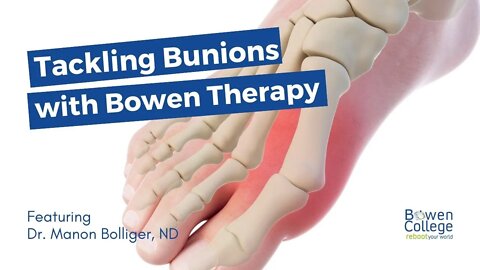 Tackling Bunions with Bowen Therapy