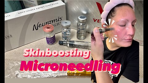 Skinboosting Cosmetic Microneedling