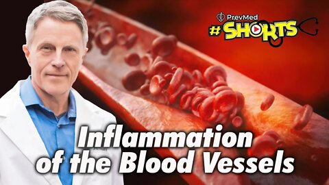 #SHORTS Inflammation of the Blood Vessels