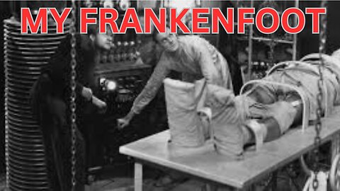 My Franken Foot