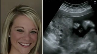 Pregnant Mom Gets Ultrasound. Doctor Sees Something Alarming.