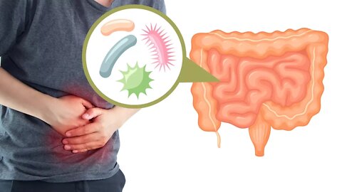 9 Signs You Have An Unhealthy Gut
