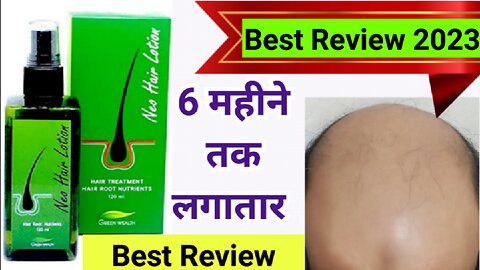 Neo Hair Lotion Best Review 2023