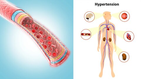 10 Power Foods That Lower Blood Pressure Naturally