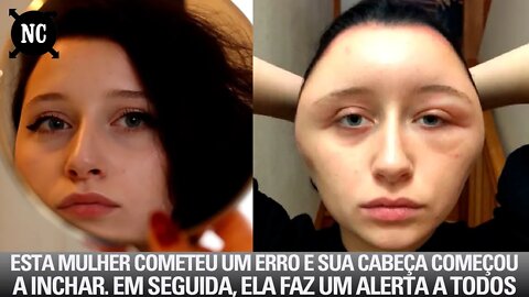 Esta Mulher Cometeu Um Erro E Sua Cabeça Começou A Crescer. Em Seguida, Ela Faz Um Alerta A Todos