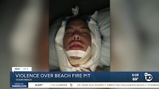 Man attacked over fire pit in Ocean Beach