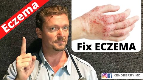 Is this Causing Your ECZEMA? (Easy Way to Tell) 2021