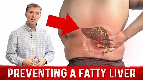 How to Prevent Fatty Liver When You Lose Weight – Dr.Berg
