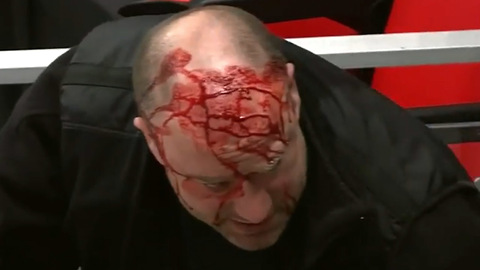 Sabres Cameraman GUSHES Blood After Taking a Hockey Puck to the Head