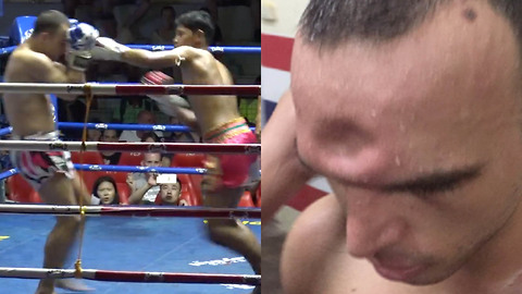 Muay Thai Fighter Gets His Skull CRUSHED in During Fight