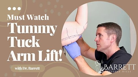 Amazing Arm Lift And Tummy Tuck! | Barrett Plastic Surgery