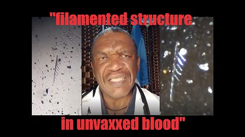 Dr Stokes: blood from an unvaxxed but swabbed patient