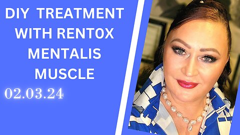 DIY TREATMENT OF MENTALIS MUSCLE WITH RENTOX 2.3.24