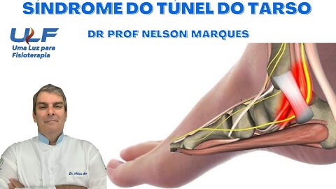 SÍNDROME DO TÚNEL DO TARSO - Dr. Prof. Nelson Marques