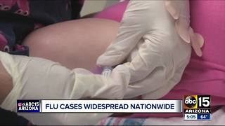 CDC says 84 kids have died from the flu