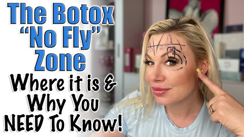 The Botox "No Fly" Zone, What is it? | Code Jessica10 saves you Money at All Approved Vendors