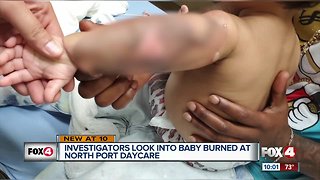 Daycare under investigation after infant gets burned severely