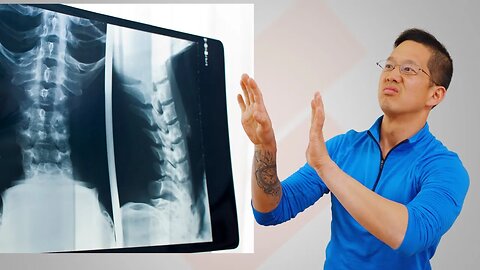 Do Not Send Me Your X-Rays! Here's Why...