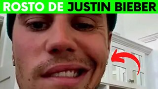 ROSTO JUSTIN BIEBER PARALISIA FACIAL