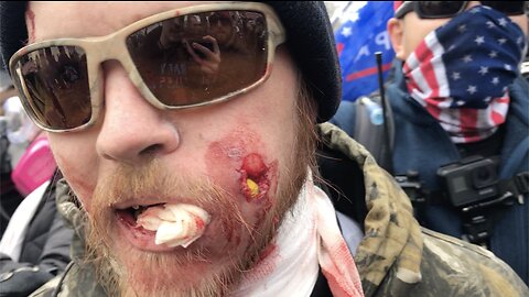 Jan 6 First Moments: Peaceful protestor shot in the face by Capitol Police.