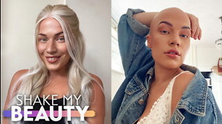 I Lost All My Hair At 18 | SHAKE MY BEAUTY