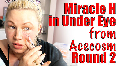 OLD VIDEO RESHARE Miracle H in Under Eyes: Build Collagen! AceCsom, Code Jessica10 Saves you Money