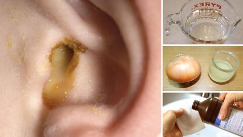 6 Best Home Remedies for Getting Rid of Swimmer's Ear