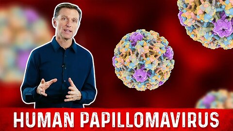 Best Remedy for HPV (Human Papillomavirus Infection) – HPV Sexually Transmitted Infection – Dr.Berg