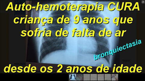 AUTO-HEMOTERAPIA CURA CRIANÇA DE 8 ANOS QUE SOFRIA DE FALTA DE AR DESDE OS 2 ANOS DE IDADE