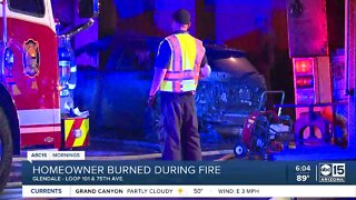 Man transported for burns after fire breaks at home in Glendale