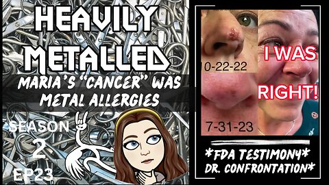 EP23 Marias "Cancer" Was Metal Allergies!