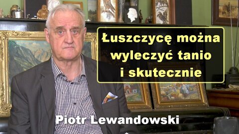 Łuszczycę można wyleczyć tanio i skutecznie - Piotr Lewandowski