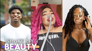 Our Differences Won’t Stop Us From Modelling | SHAKE MY BEAUTY